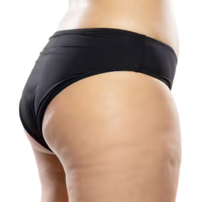 How to reduce the appearance of cellulite